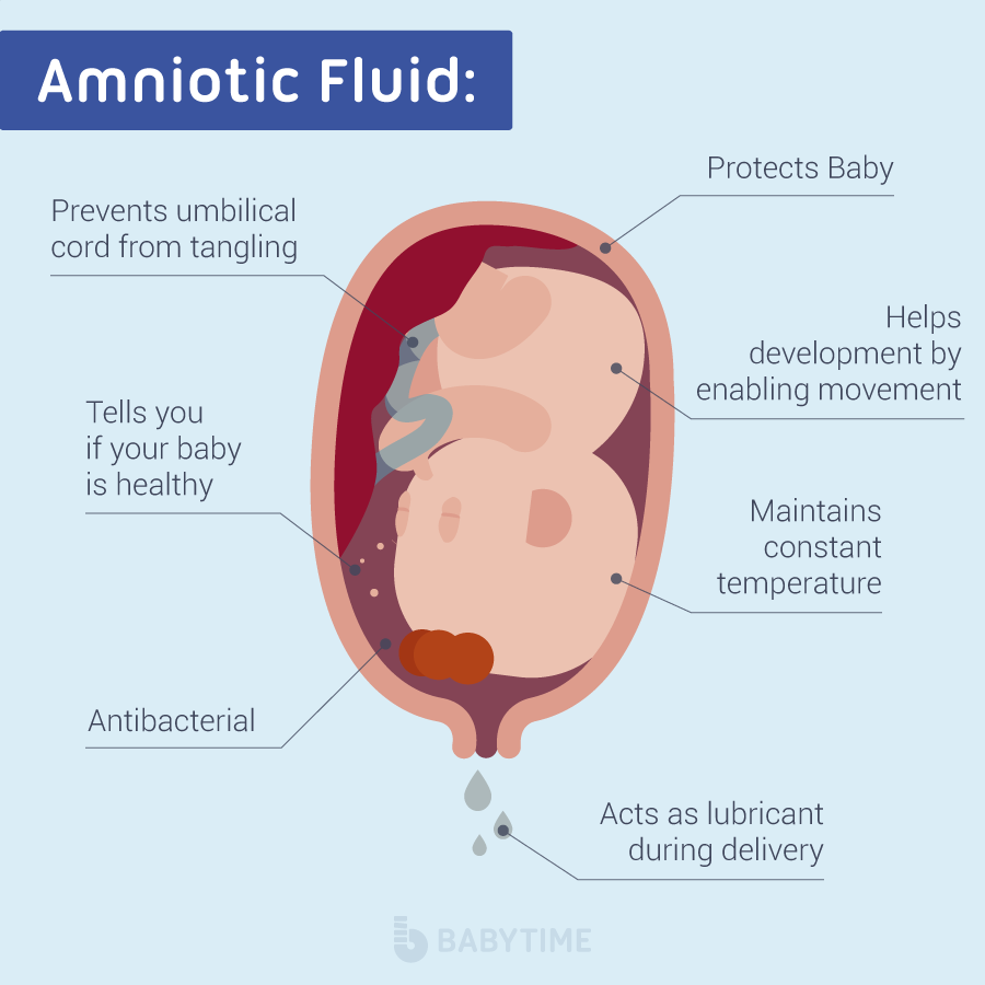 breech presentation low amniotic fluid